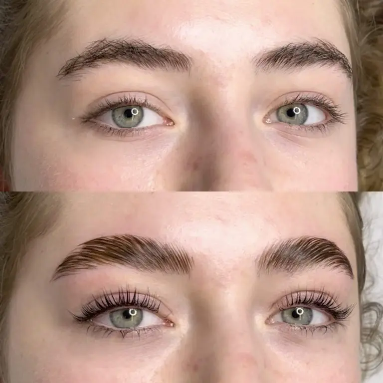 brow lifting schwangerschaft - Was muss man vor dem Browlifting beachten