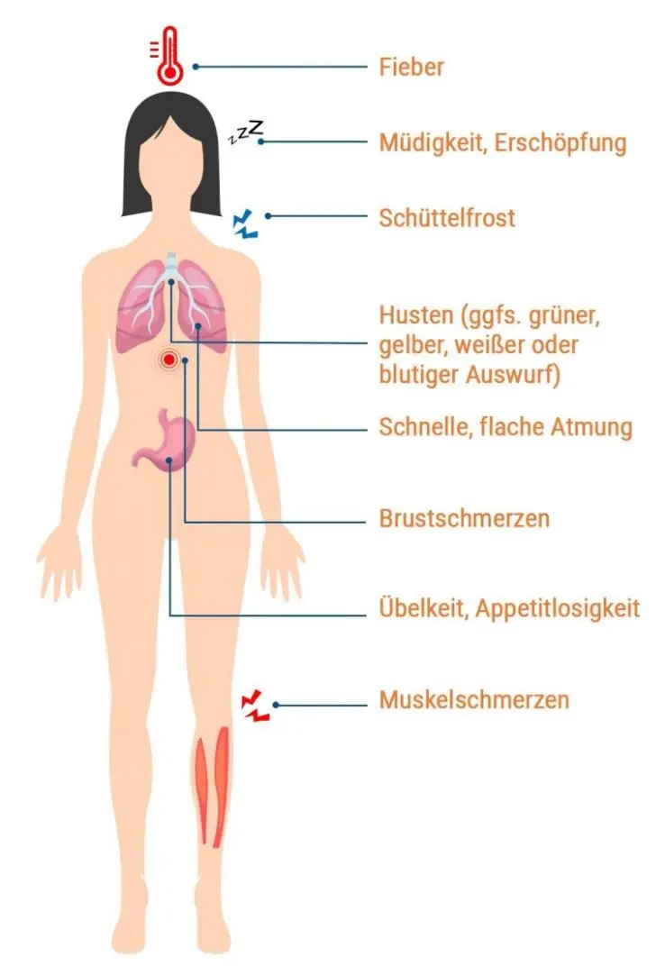 verschleppte lungenentzündung symptome - Was passiert wenn eine Lungenentzündung unbehandelt bleibt