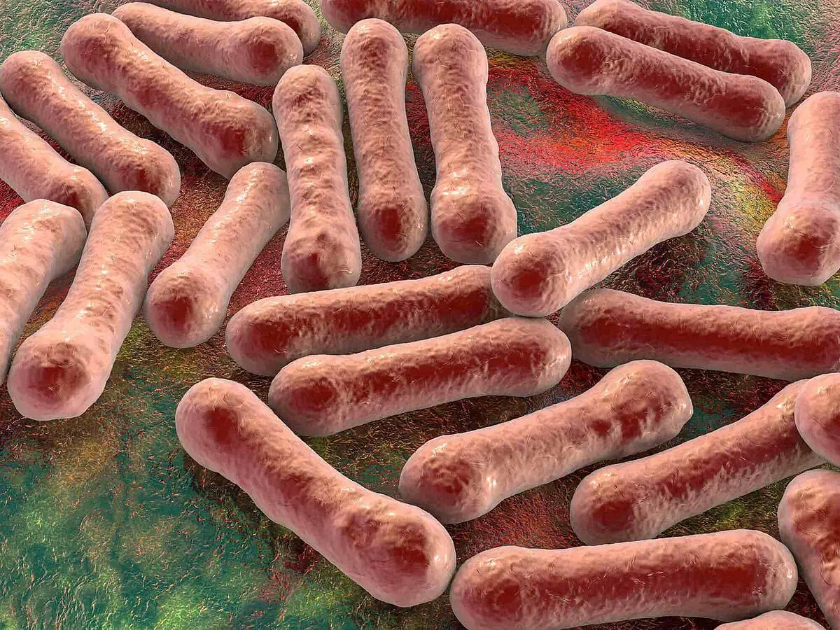 symptome von diphtherie - Was passiert wenn man Diphtherie nicht behandelt