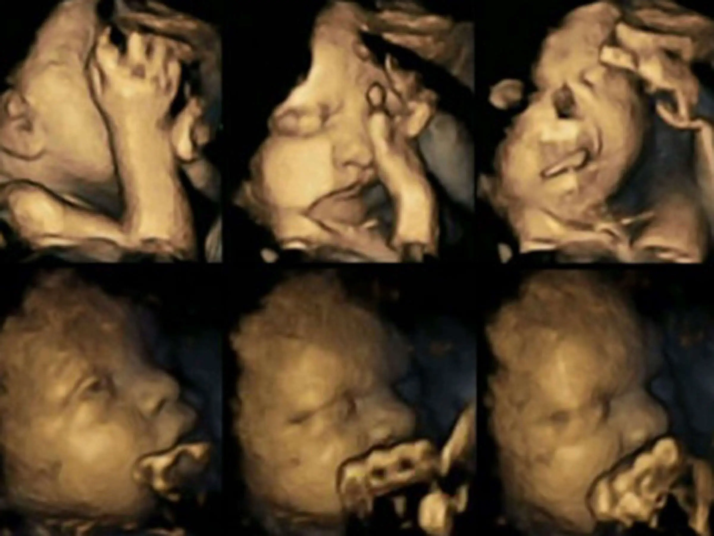 raucherin schwangerschaft - Was passiert wenn man nicht weiß dass man schwanger ist und raucht