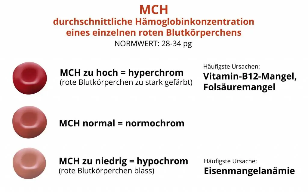 hbe mch wert - Was sagt der HbE Wert im Blut aus