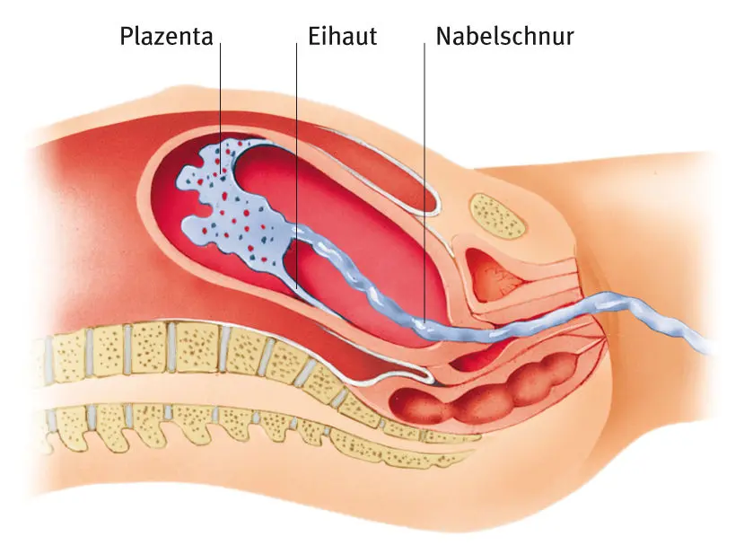 Eihautreste nach der Geburt: Was Sie wissen müssen - Was sind Eihautreste eihaut nach geburt - Was sind Eihautreste