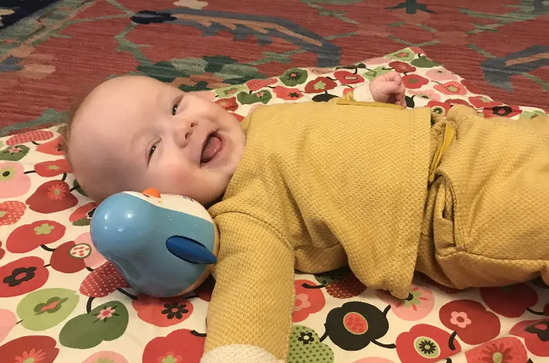 amnionband schwangerschaft - Was sind Schnürfurchen