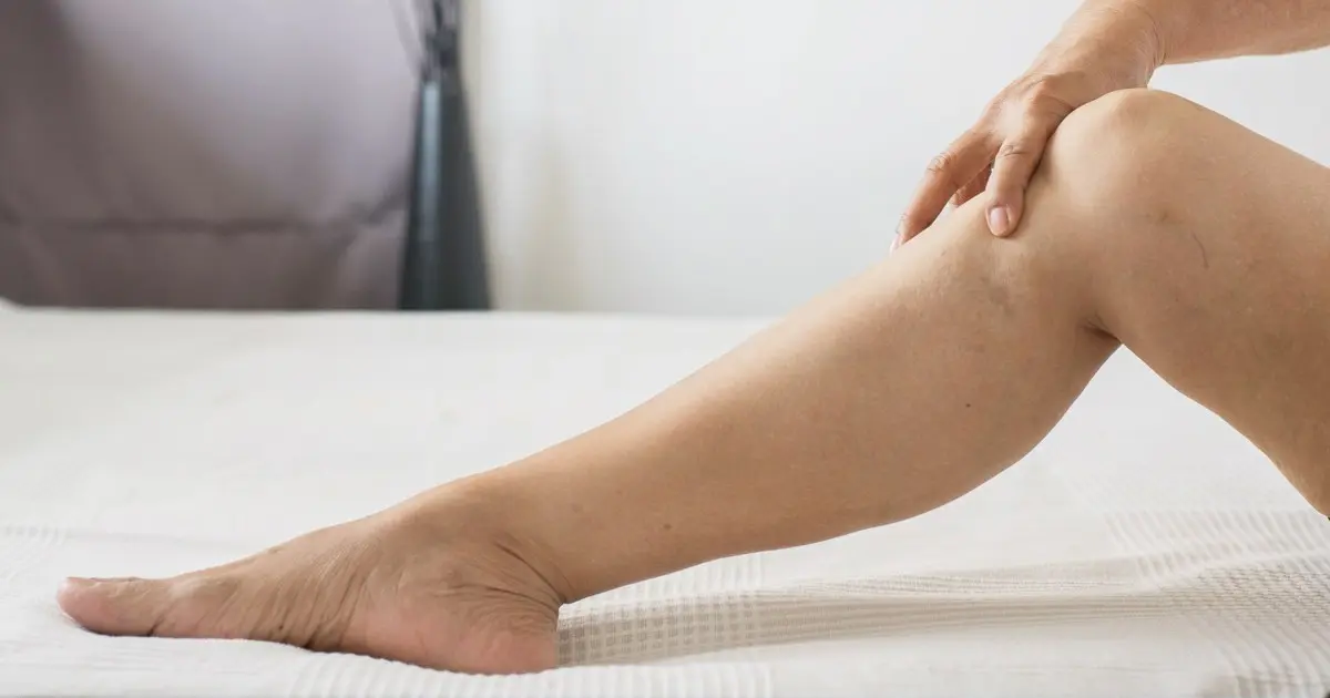 vene schwangerschaft - Was sind Venen Schwangerschaft