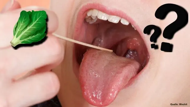 essen bei mandelentzündung - Was sollte man bei einer Mandelentzündung essen und trinken