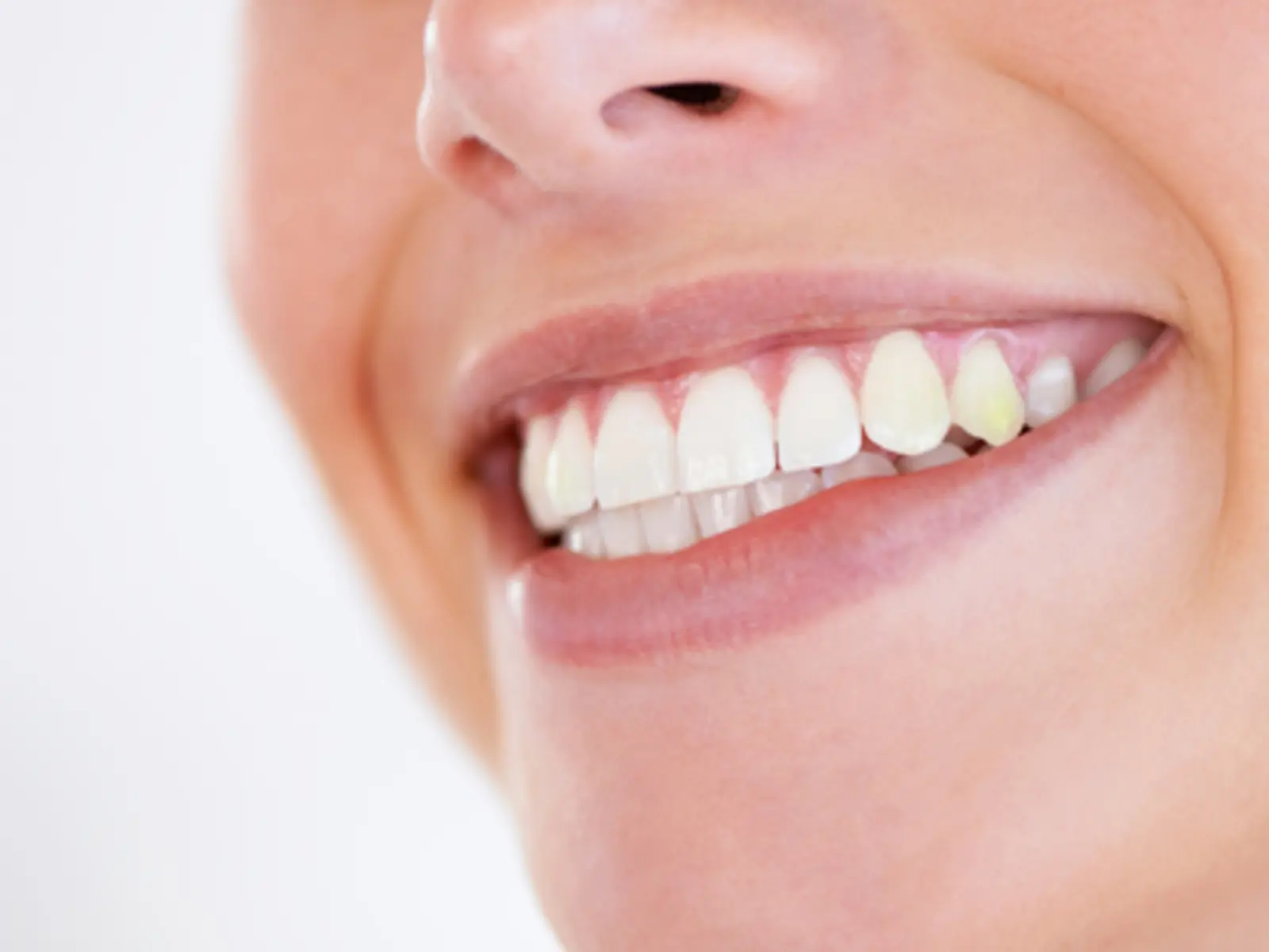 Gelbe Eckzähne: Ursachen, Vorbeugung und Behandlung - Was tun bei gelben Eckzähnen eckzähne gelb - Was tun bei gelben Eckzähnen