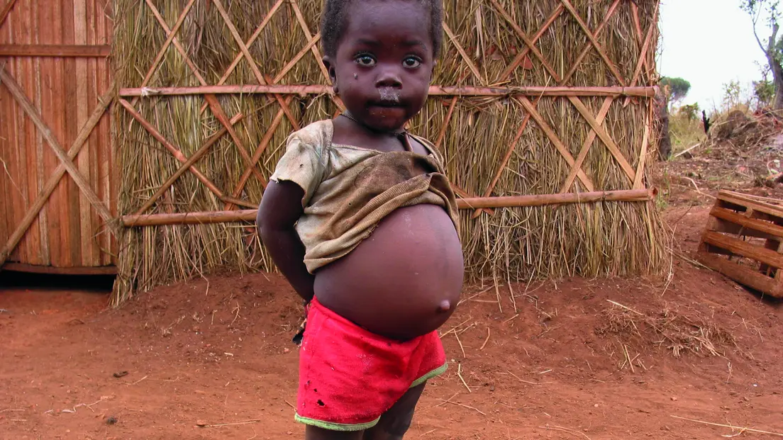 harter aufgeblähter bauch kleinkind - Was tun bei hartem Bauch Kleinkind