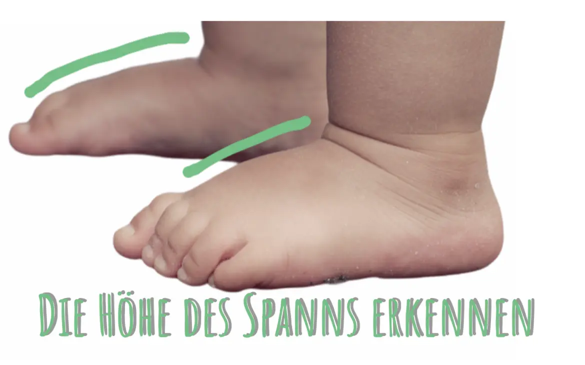 kinderschuhe breiter fuß hoher spann - Was tun bei hohem Spann