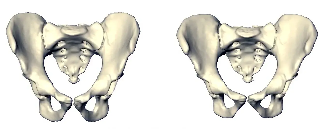 hüfte nach geburt - Was tun bei Hüftschmerzen nach Geburt