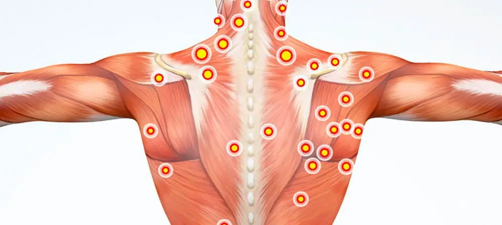 Muskelverhärtung in der Schulter: Ursachen, Symptome und Behandlung - Was tun bei Muskelverhärtung in der Schulter muskelverhärtung schulter - Was tun bei Muskelverhärtung in der Schulter