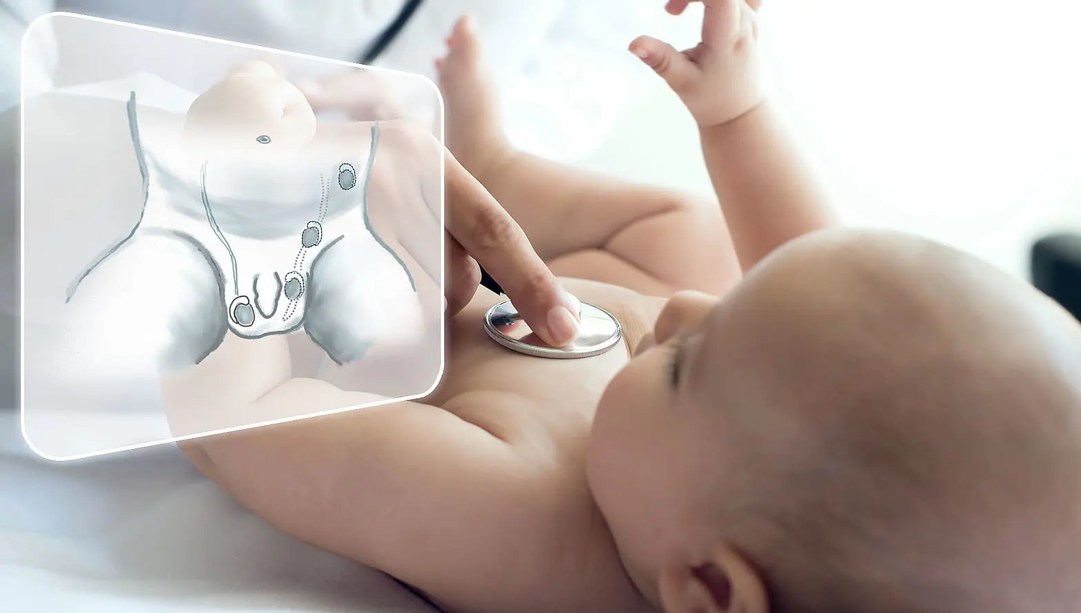 phimose bei kleinkindern - Was tun bei Phimose Kind