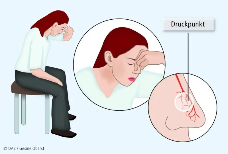 Häufige Nasenbluten: Ursachen, Symptome und Behandlung - Was tun bei ständig Nasenbluten häufige nasenbluten - Was tun bei ständig Nasenbluten