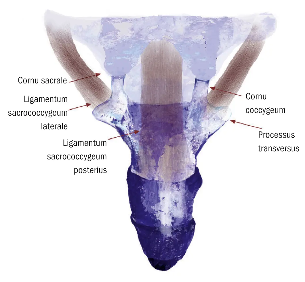 Steißbein nach Geburt verschoben: Ursachen, Symptome und Behandlung - Was tun bei Steißbein Verkrümmung steißbein nach geburt verschoben - Was tun bei Steißbein Verkrümmung