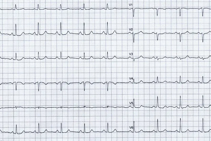 herzstolpern nach geburt - Was tun damit Herzstolpern aufhört