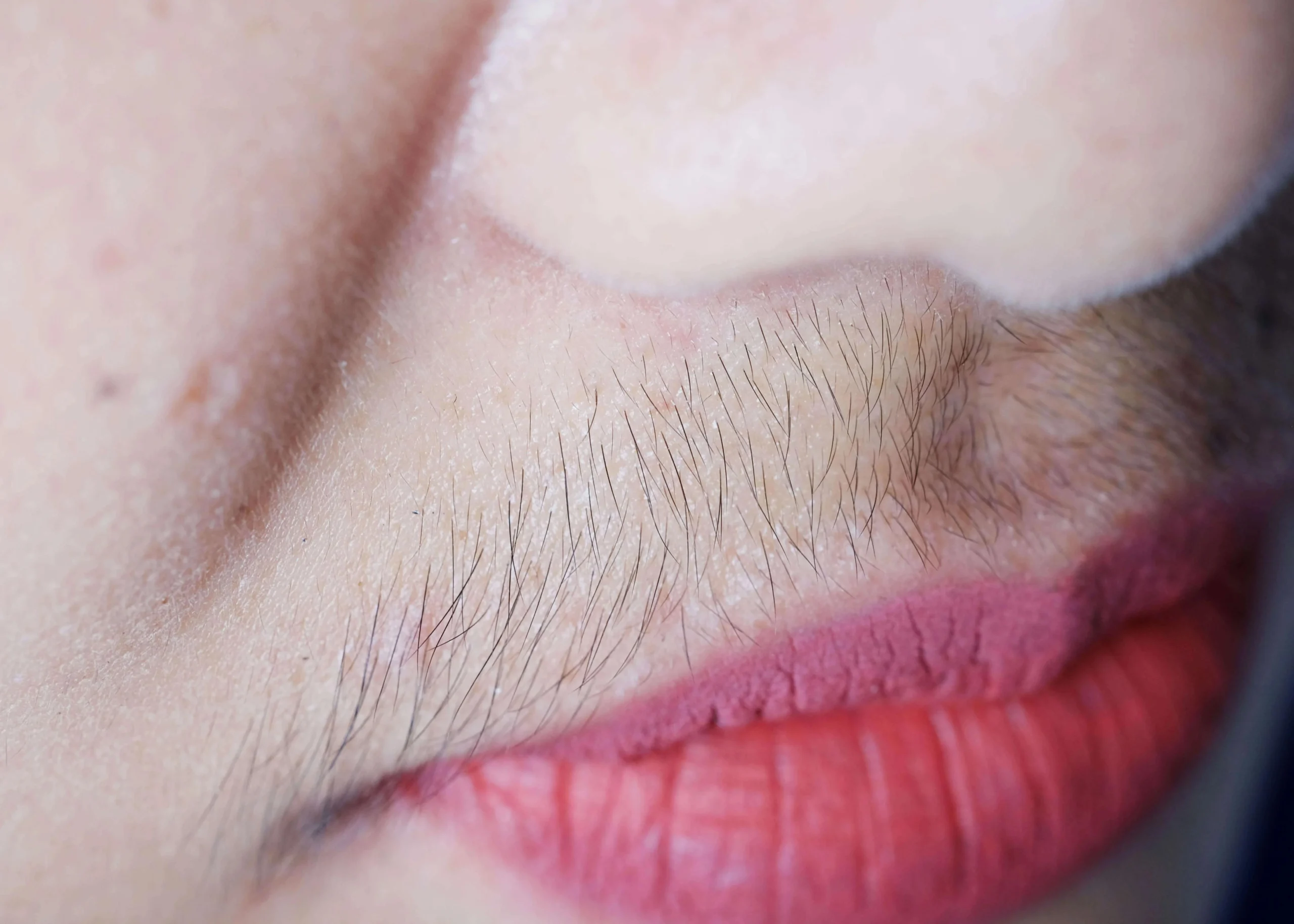 damenbart nach geburt - Was tun gegen Damenbart Hormone