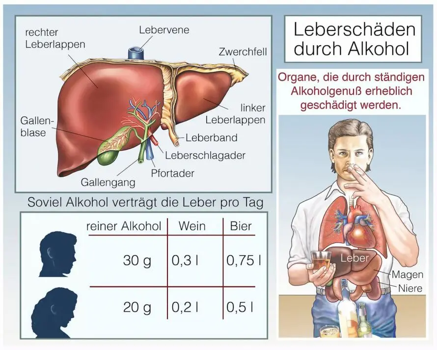 fettleber schwangerschaft - Was tun gegen Fettleber Schwangerschaft