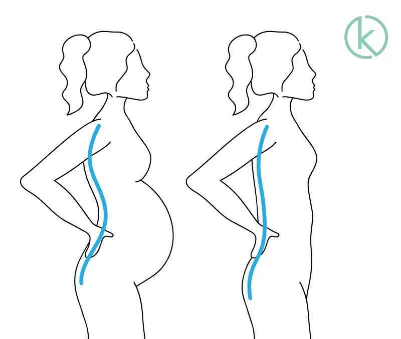hohlkreuz schwangerschaft - Was tun gegen Hohlkreuz nach Schwangerschaft
