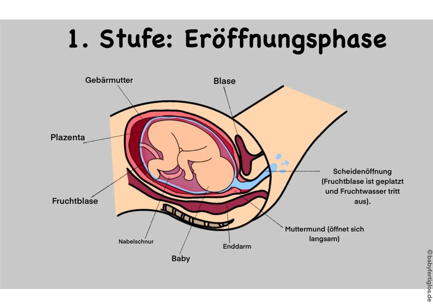 latenzphase schwangerschaft - Was tun in der Latenzphase