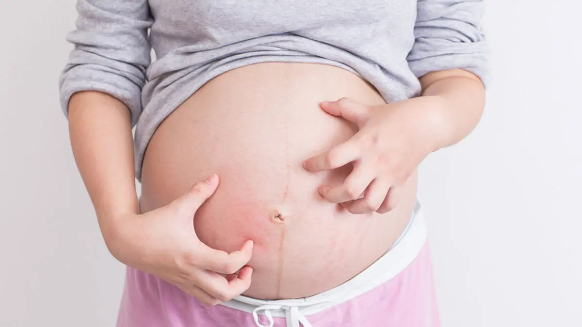 bauch juckt schwangerschaft ab wann - Was tun wenn Bauch juckt