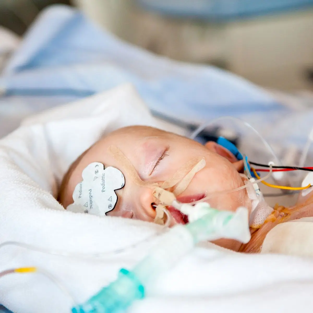 scharlach während geburt - Was tun wenn ein Familienmitglied Scharlach hat