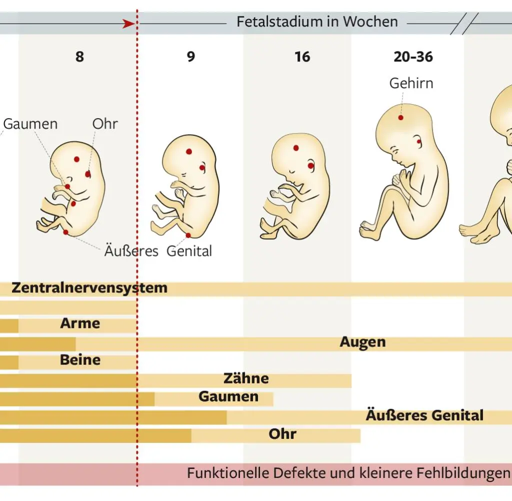 angst vor fehlbildungen schwangerschaft - Was verursacht Missbildungen bei Babys