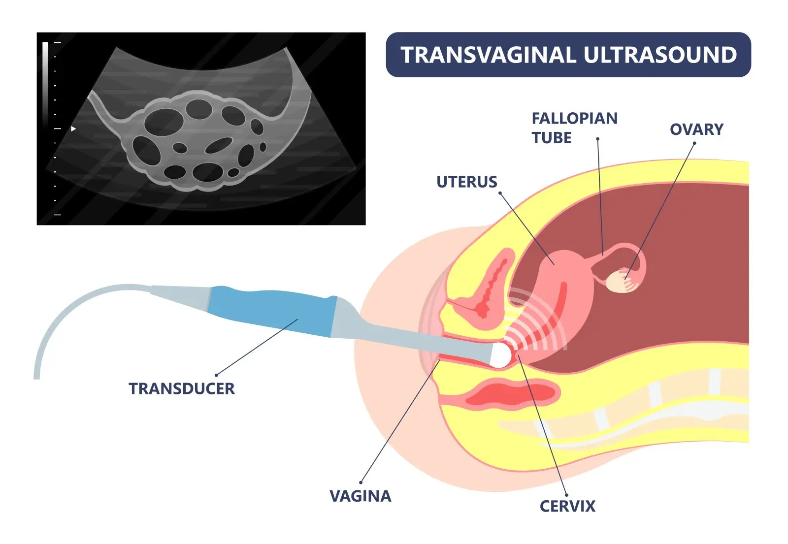 schmerzen im unterleib nach frauenarztbesuch - Was wenn Abstrich weh tut
