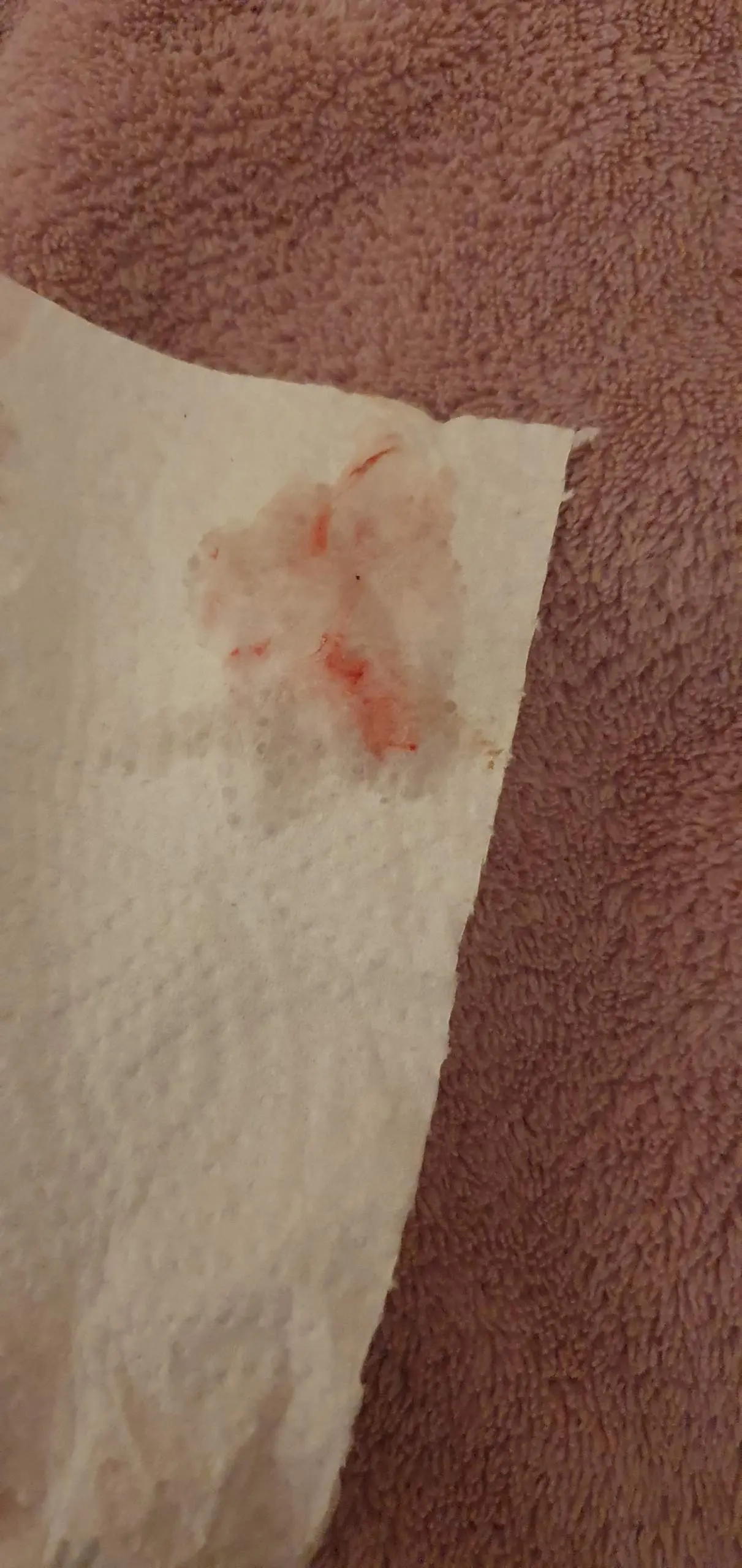beim schneuzen blut - Was wenn beim Nase putzen Blut mitkommt