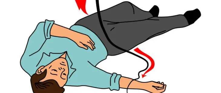 stromunfälle - Welche Arten von stromunfällen gibt es