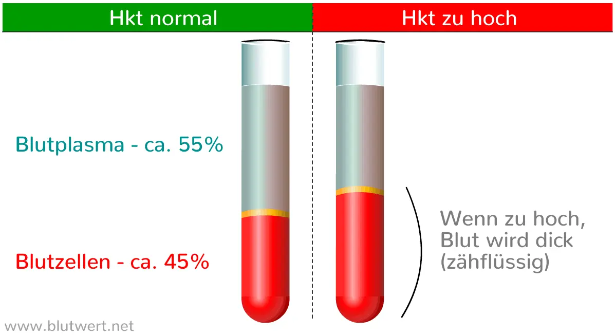 hämatokrit wert erhöht - Welche Aussage kann der Hämatokrit treffen