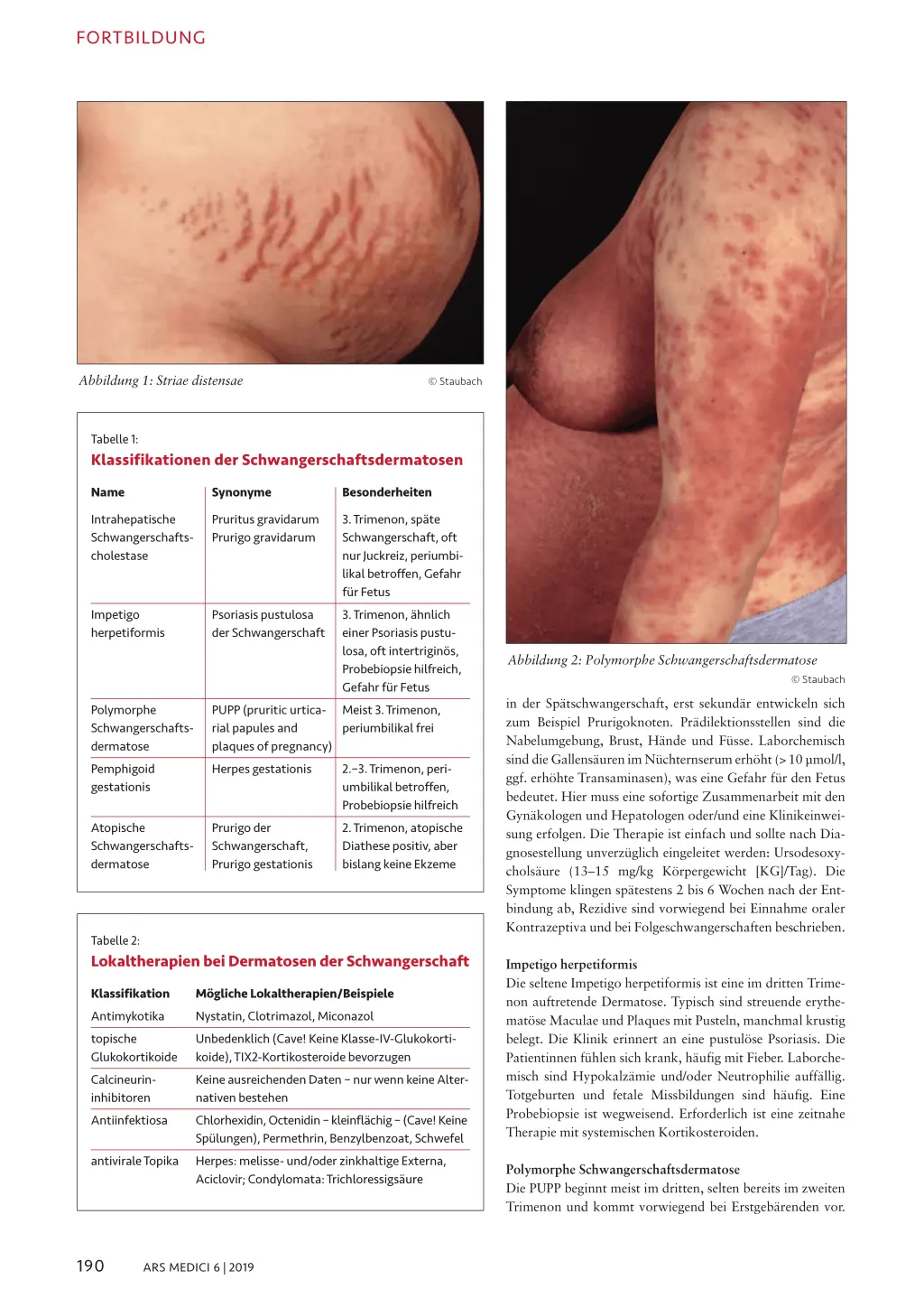 schwangerschaftsdermatose nach geburt - Welche Creme bei Schwangerschaftsdermatose