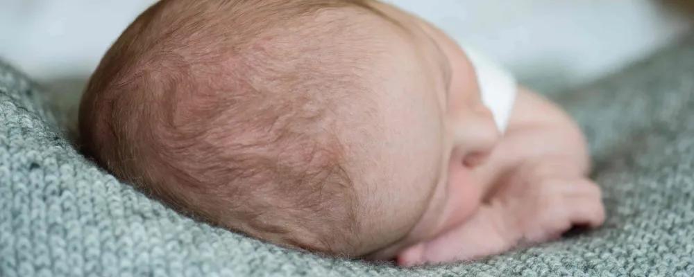 kopfform babys - Welche Kopfformen sind normal