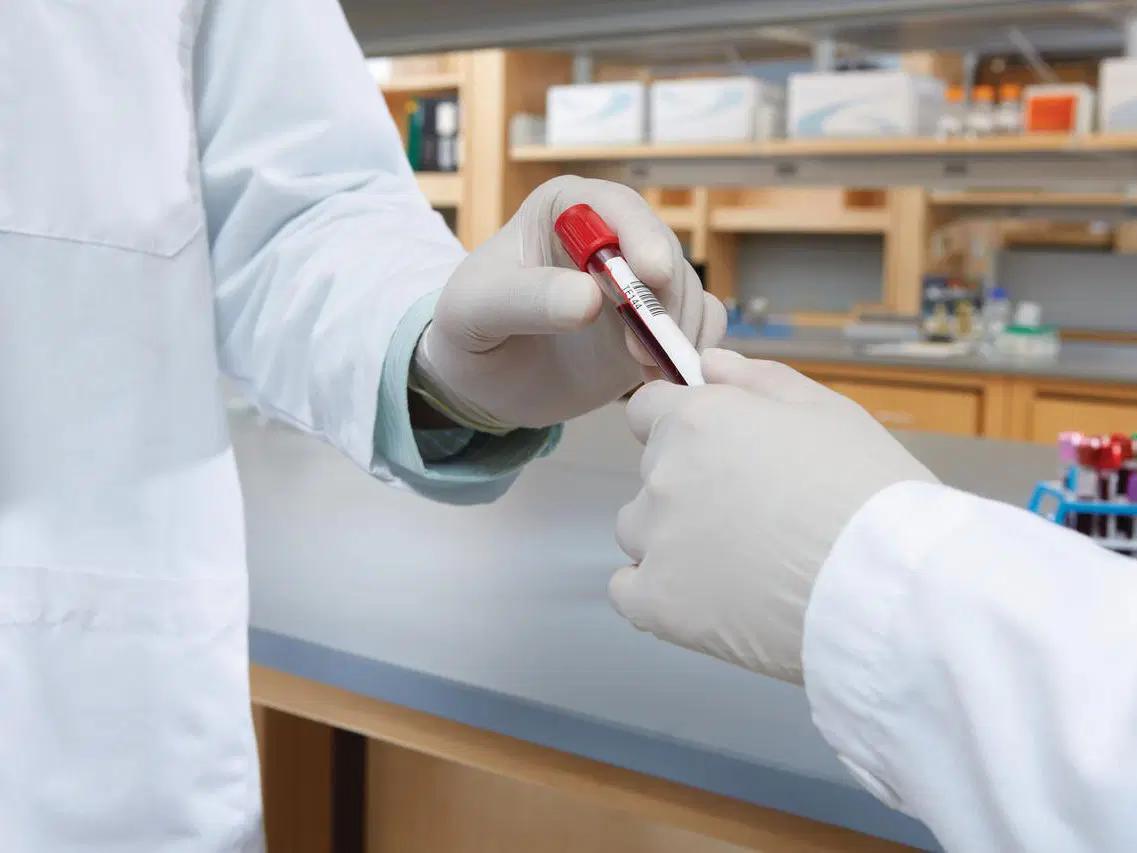 torch test schwangerschaft - Welche Laborparameter beinhaltet die TORCH Diagnostik