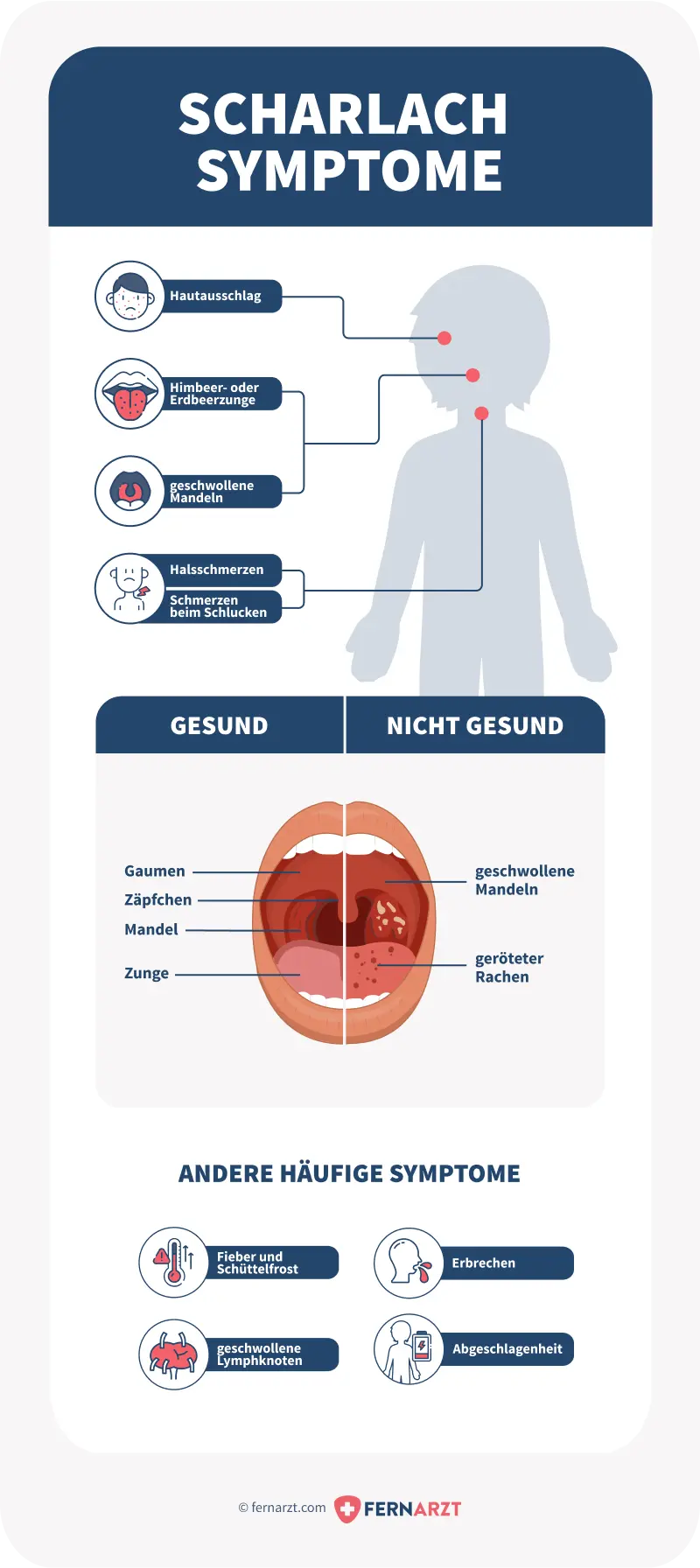 Medikamente gegen Scharlach: Was hilft schnell und effektiv? - Welche Medikamente Scharlach medikamente gegen scharlach - Welche Medikamente Scharlach