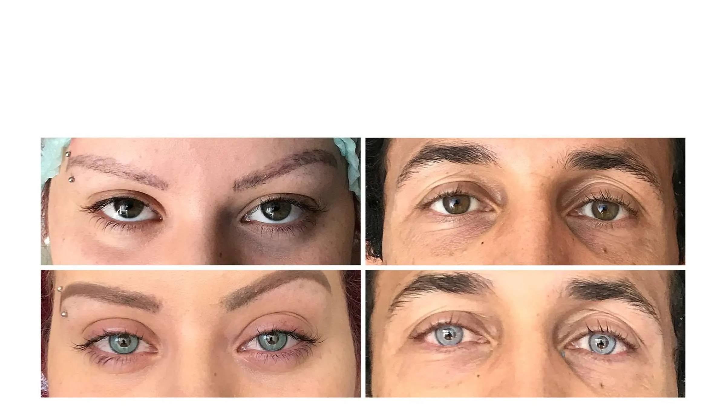 augen verändern farbe - Welche Medikamente verändern die Augenfarbe