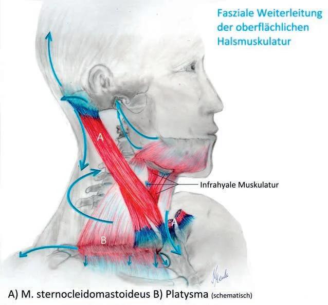 muskelverhärtung am hals - Welche Muskeln sind seitlich am Hals
