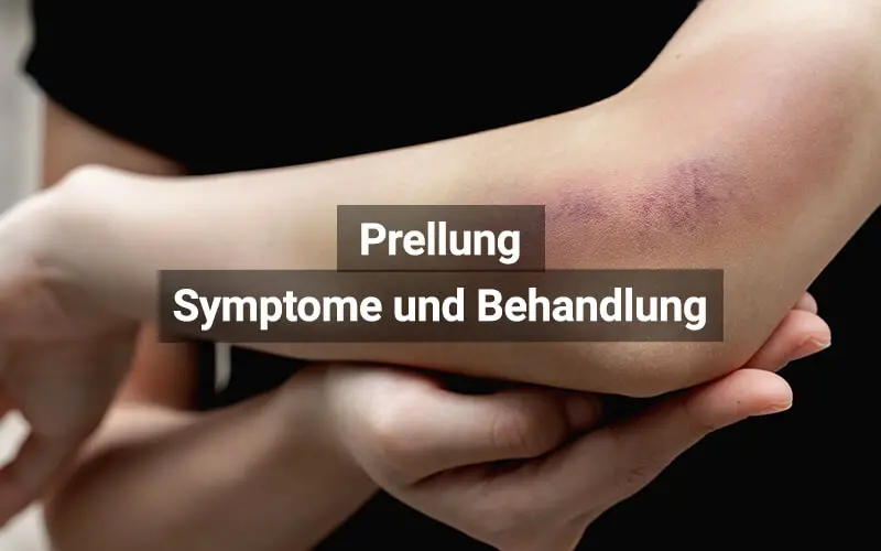 Prellung Kind: Wann zum Arzt? - Welche Salbe bei Prellungen bei Kindern prellung kind wann zum arzt - Welche Salbe bei Prellungen bei Kindern