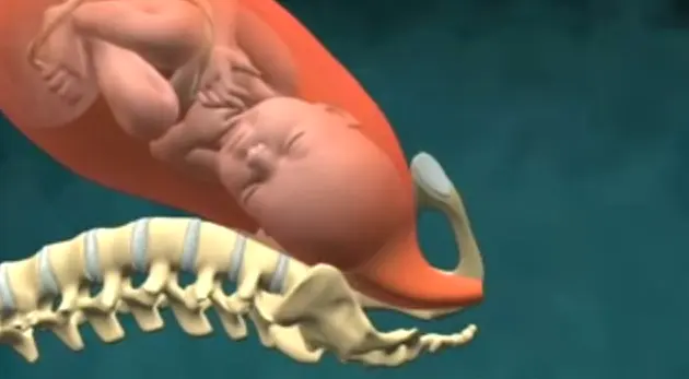 steißbeinschmerzen nach geburt osteopathie - Welcher Arzt ist für das Steißbein zuständig