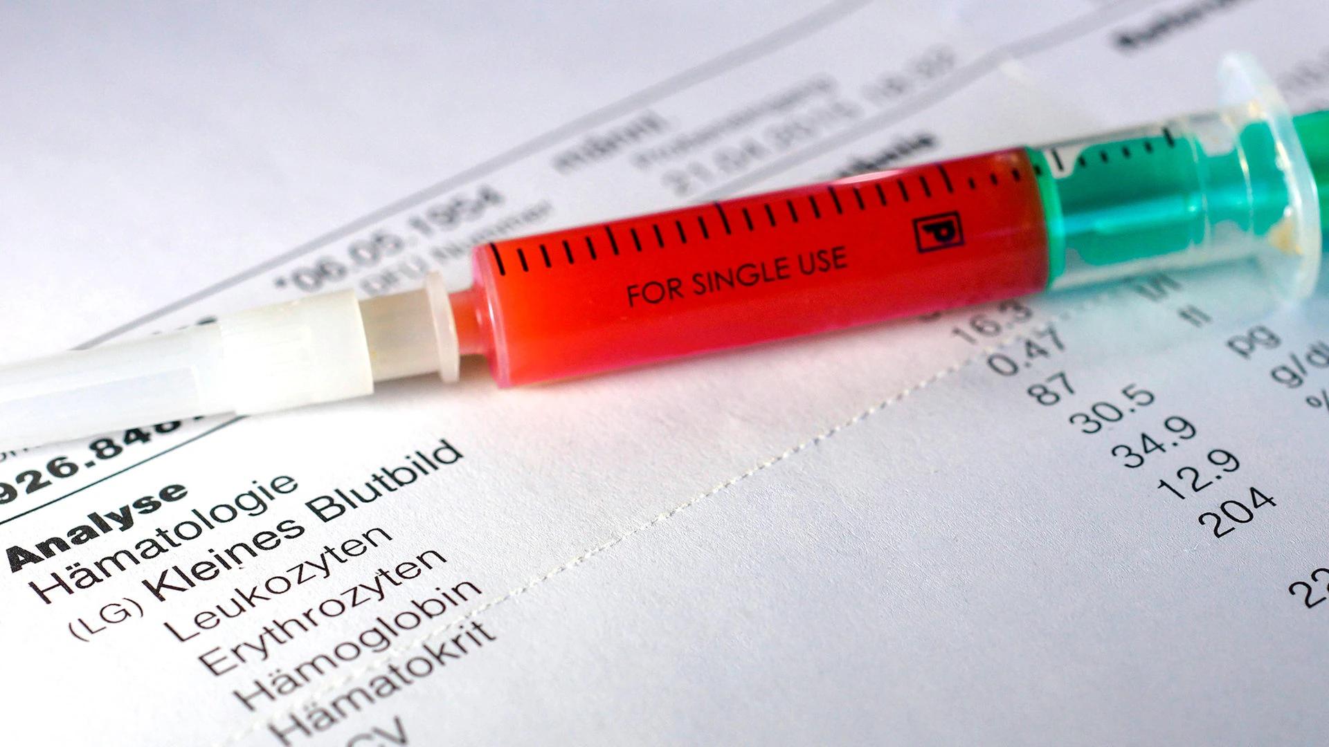 hämatokrit blutwerte - Welcher blutwert zeigt zu wenig trinken