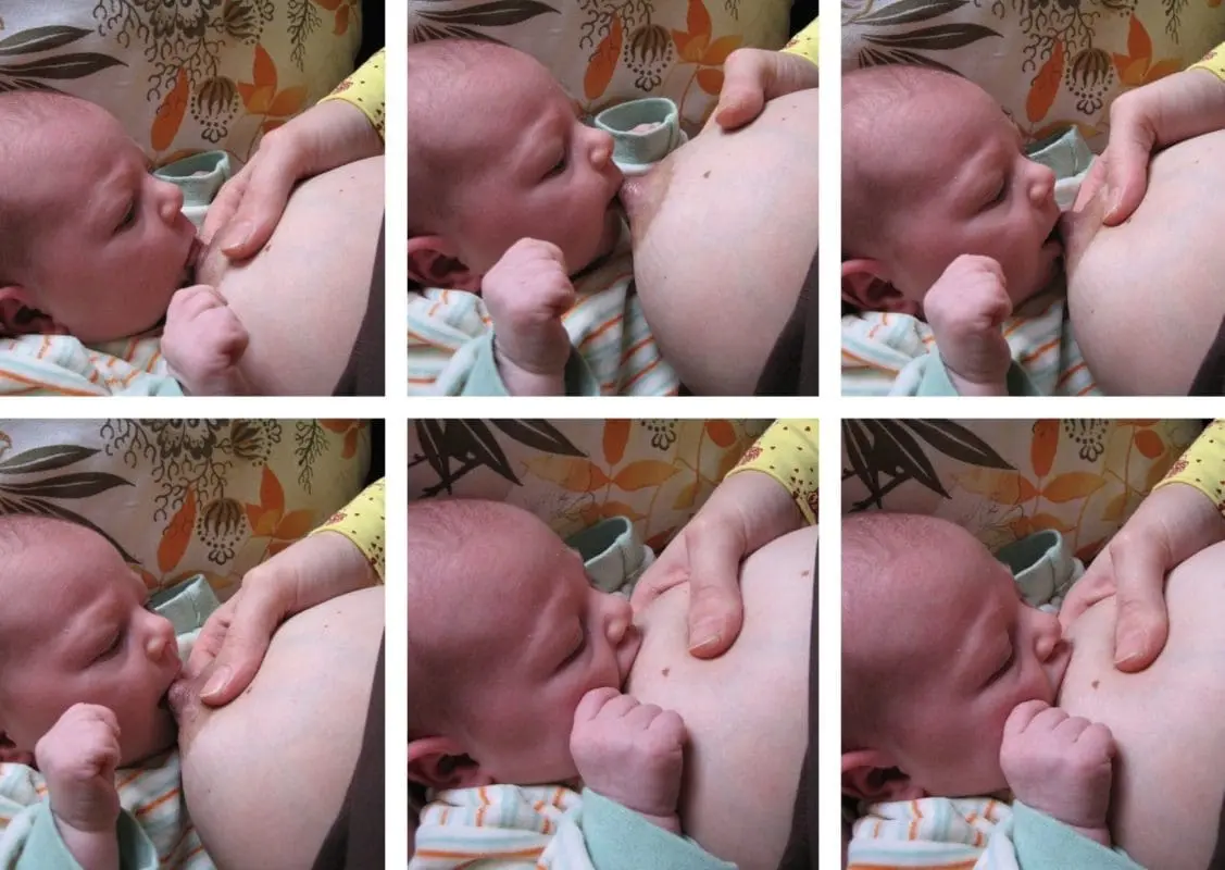 entzündete brustwarzen hausmittel - Welcher Tee bei wunden Brustwarzen