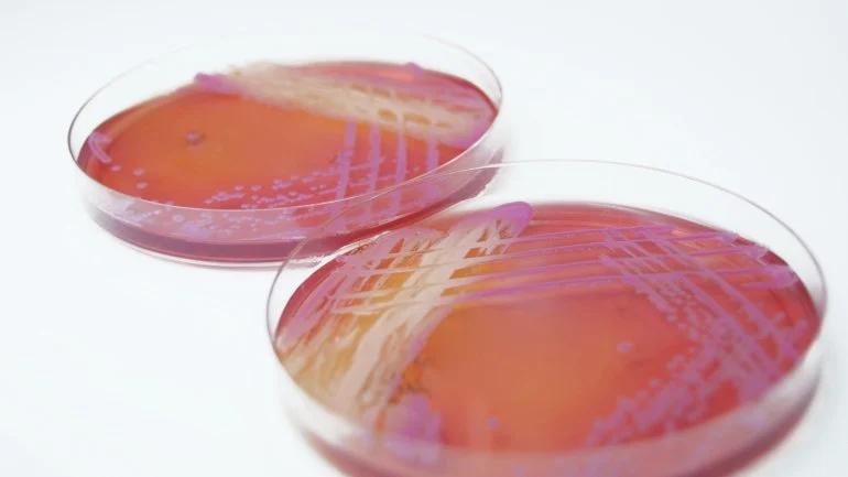 staphylococcus aureus hausmittel - Welcher Tee gegen Staphylococcus aureus