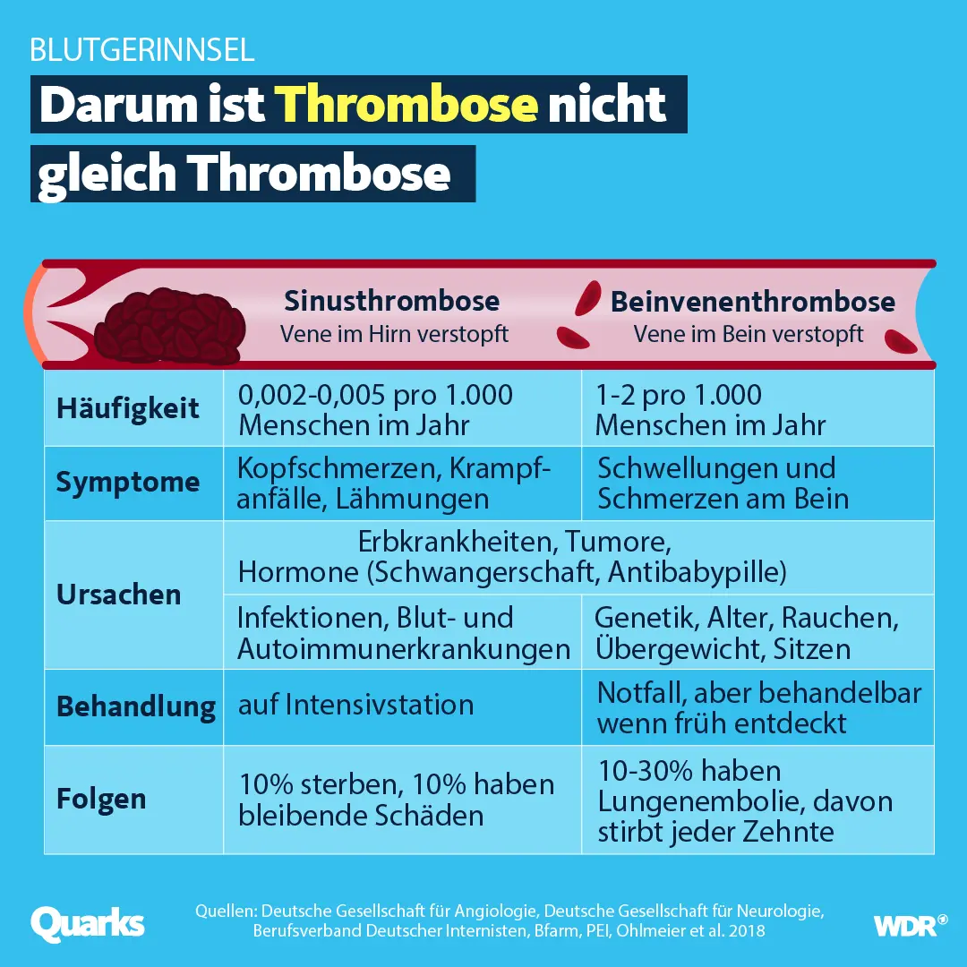 sinusvenenthrombose schwangerschaft - Welches Medikament bei Sinusvenenthrombose