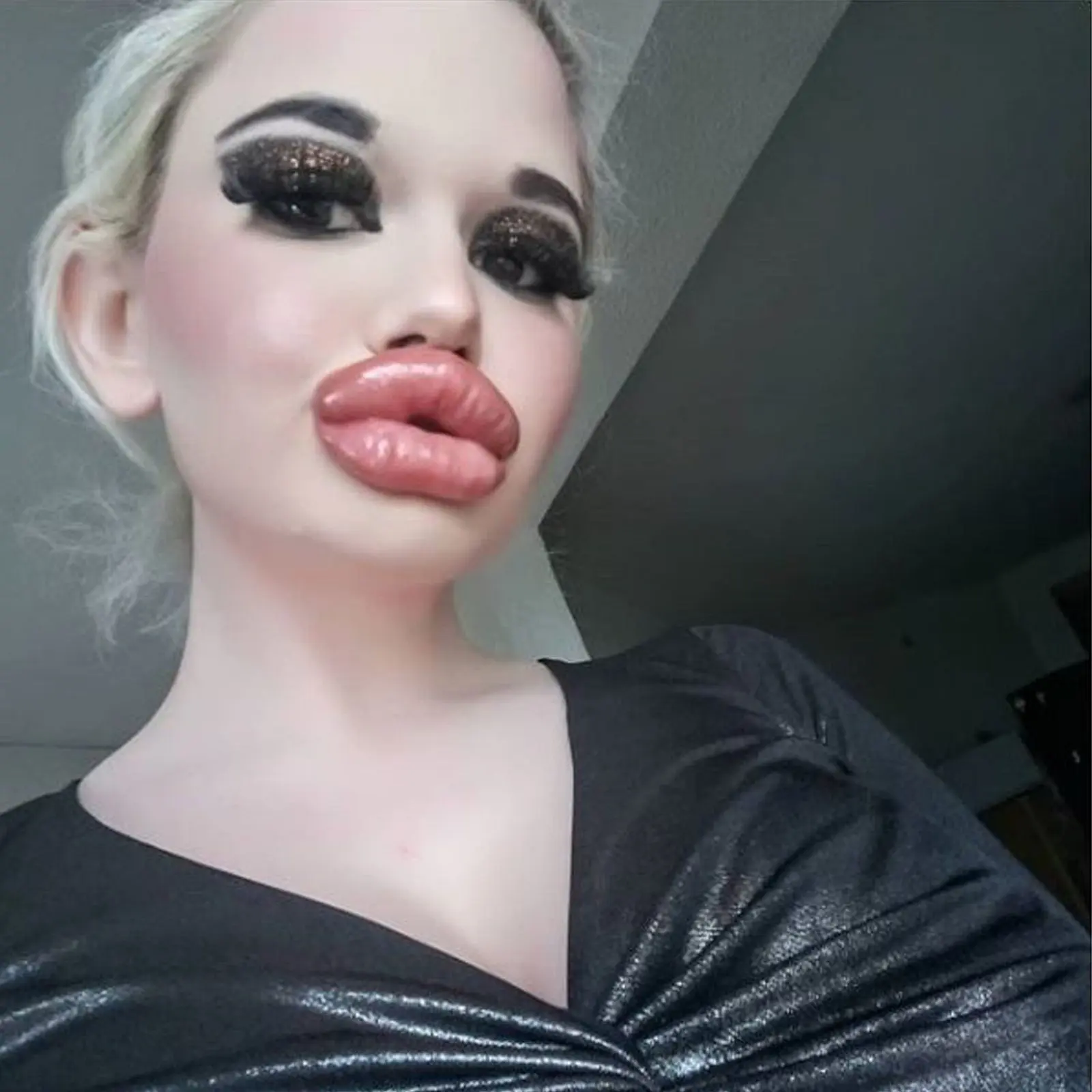 die kleinsten lippen der welt - Wer hat die größten aufgespritzten Lippen