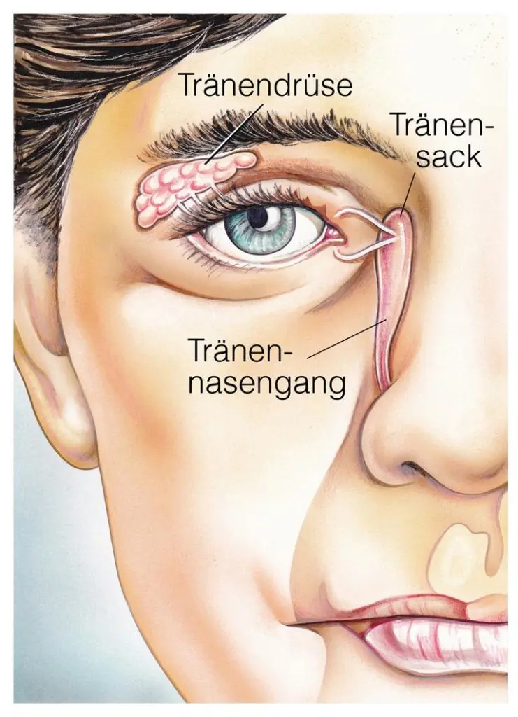 tränengangstenose - Wie äußert sich ein verstopfter Tränenkanal