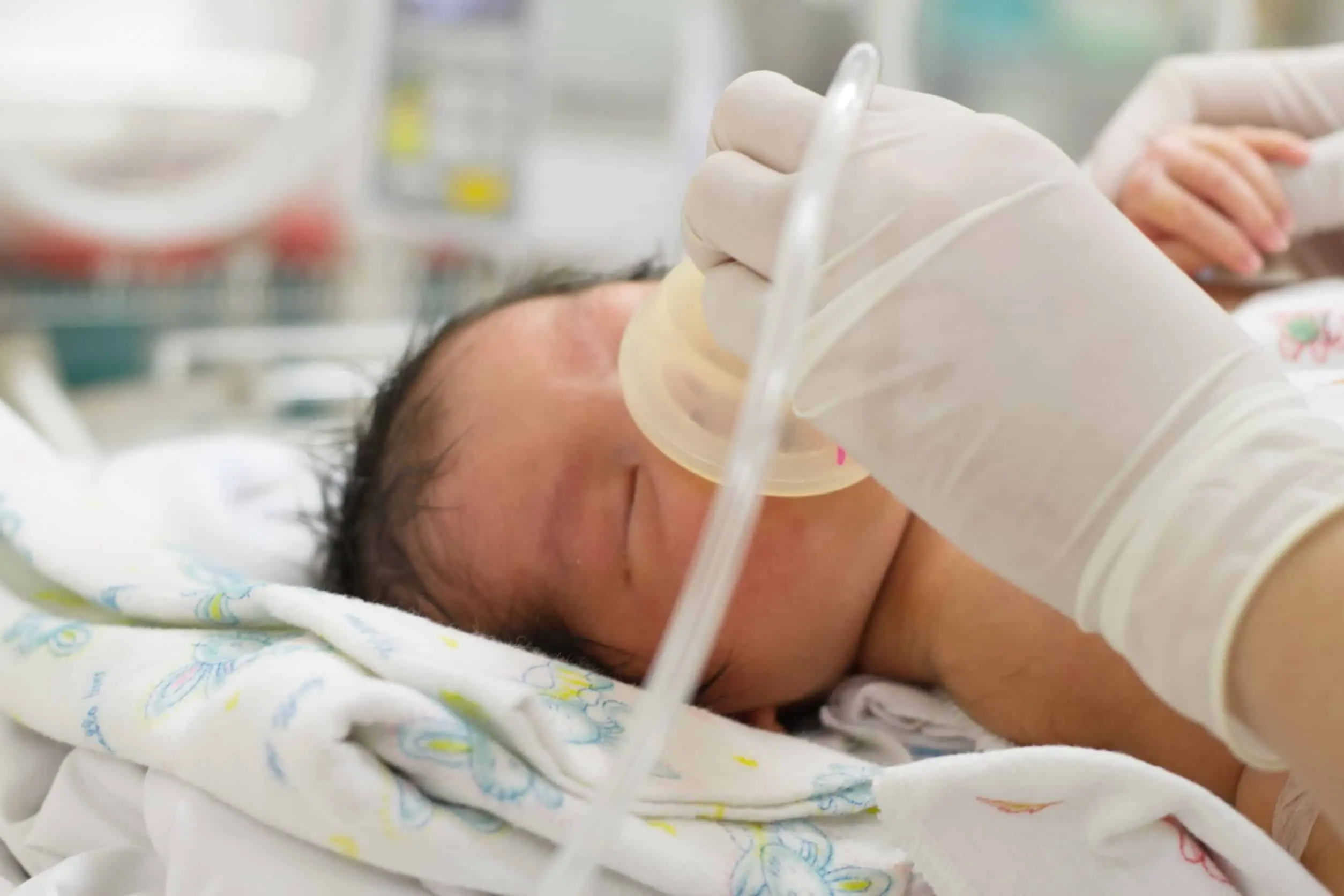 asphyxie geburt - Wie äußert sich Sauerstoffmangel bei der Geburt