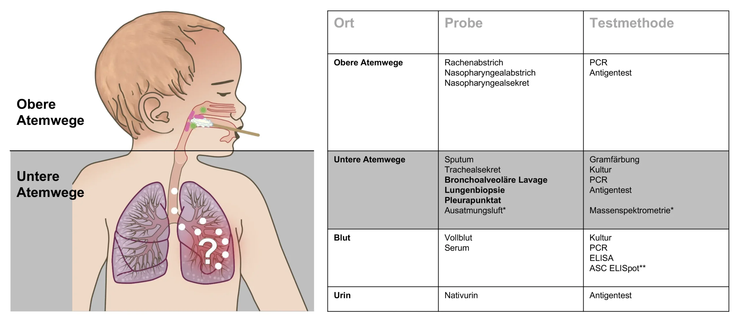 atypische lungenentzündung kind - Wie behandelt man eine atypische Pneumonie