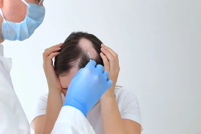 kahle stelle am kopf seit geburt - Wie bekommt man kahle Stellen am Kopf weg