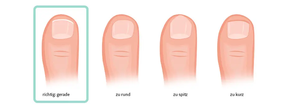 zehnagel richtig schneiden - Wie bekommt man Zehennagel weich zum Schneiden