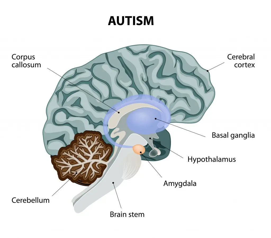 autismus ursache - Wie entsteht Autismus im Mutterleib