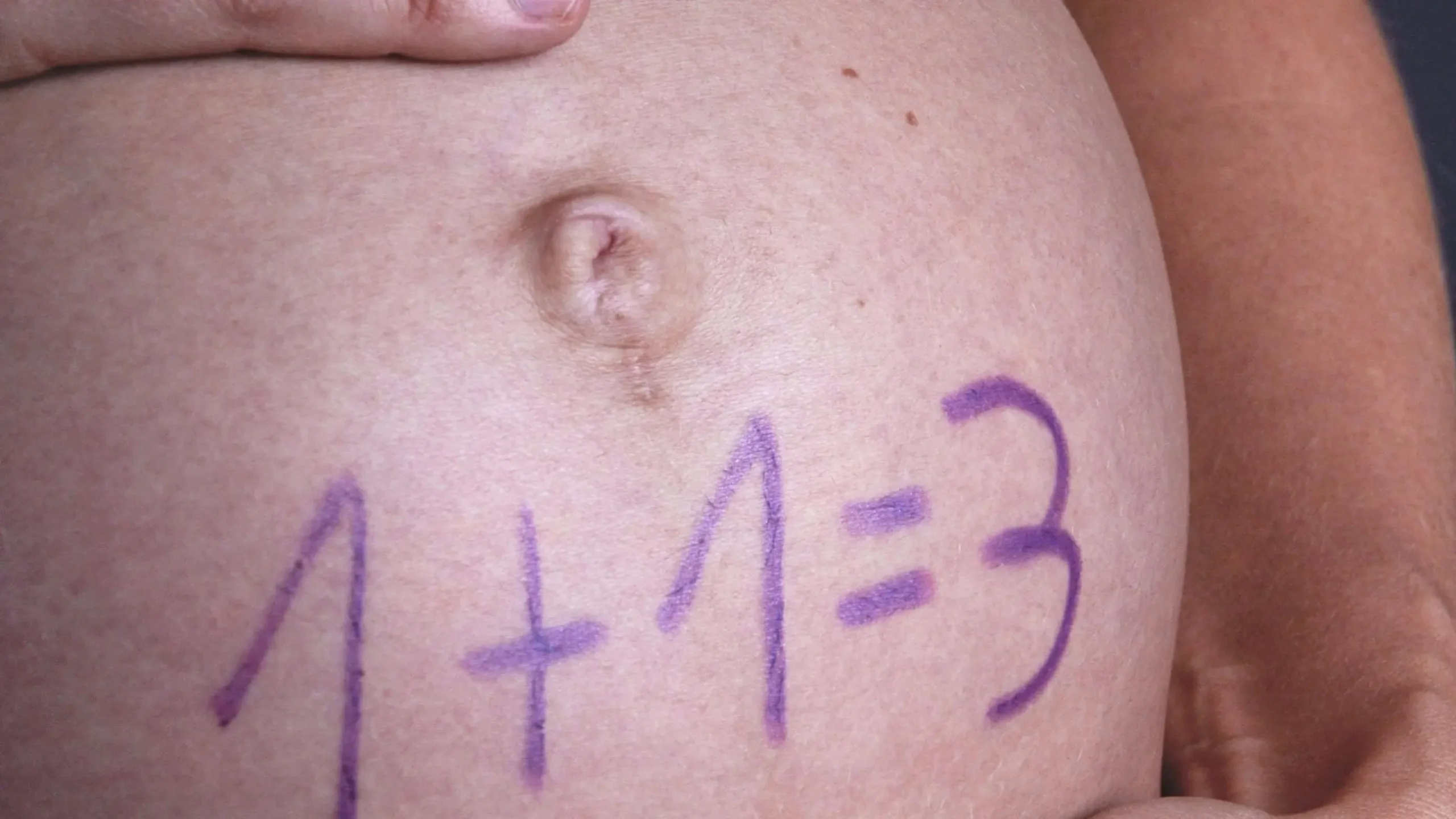 schmerzen bauchnabel nach geburt - Wie erkennt man einen Nabelbruch nach der Schwangerschaft