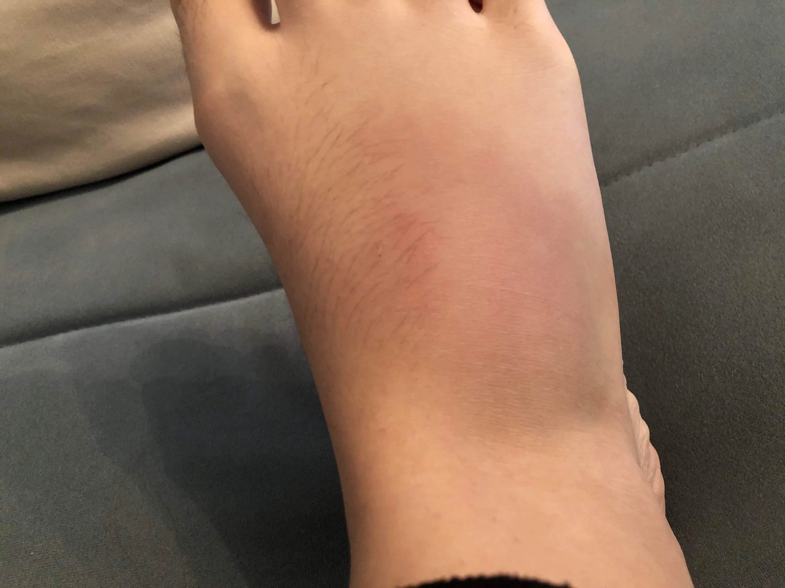 gebrochener fuß symptome - Wie erkennt man, ob ein Fuß gebrochen oder geprellt ist